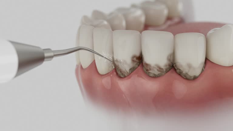 Trusted Dental Crowns And Bridges service in Boston Heights, OH - Dentist Open Now